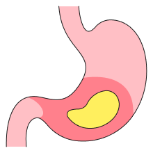 Kidney Disease Icon